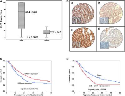 Krupple-Like Factor 5 is a Potential Therapeutic Target and Prognostic Marker in Epithelial Ovarian Cancer